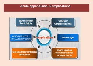Acute appendicitis- Complications
 