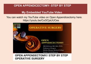 OPEN APPENDICECTOMY- STEP BY STEP
My Embedded YouTube Video
You can watch my YouTube video on Open Appendicectomy here.
https://youtu.be/CuGCjaUUCes
 