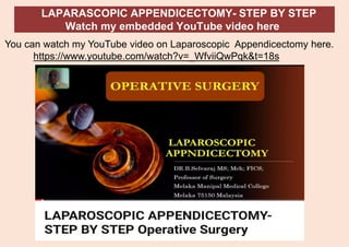 LAPARASCOPIC APPENDICECTOMY- STEP BY STEP
Watch my embedded YouTube video here
You can watch my YouTube video on Laparoscopic Appendicectomy here.
https://www.youtube.com/watch?v=_WfviiQwPqk&t=18s
 