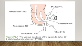 Approach to acute Acute Appendicitis.pptx