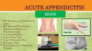 ACUTE APPENDICITIS
SIGNS
 RIF Tenderness in McBurny’s
point
 RIF Rebound Tenderness,
Release tenderness or
Blumberg’s sign
 Guarding/Rigidity
 Cope’s Psoas Test
 Cope’s Obturator Test
 Rovsing’s Sign
 Hyperasthesia in Sherren’s
Triangle
Obturator Test
 
