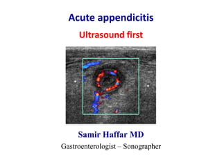 Acute appendicitis
Ultrasound first
Samir Haffar MD
Gastroenterologist – Sonographer
 