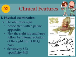 Appendix Sign Rlq Acute appendicitis in adults - Hoang Cuong HMU | PDF