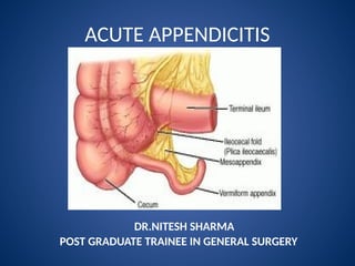 Comprehensive Overview of Acute Appendicitis: Anatomy, Pathology, and ...