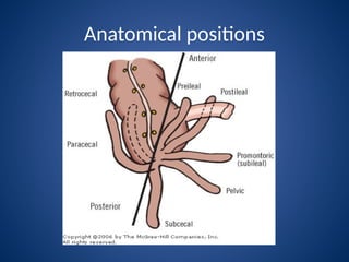 Comprehensive Overview of Acute Appendicitis: Anatomy, Pathology, and ...