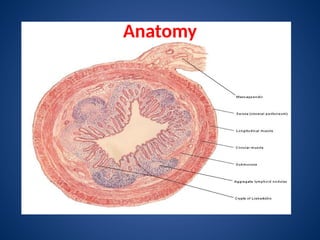 Comprehensive Overview of Acute Appendicitis: Anatomy, Pathology, and ...