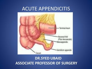 ACUTE APPENDICITIS
DR.SYED UBAID
ASSOCIATE PROFESSOR OF SURGERY
 