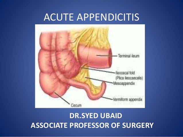 acute appendicitis amp lump