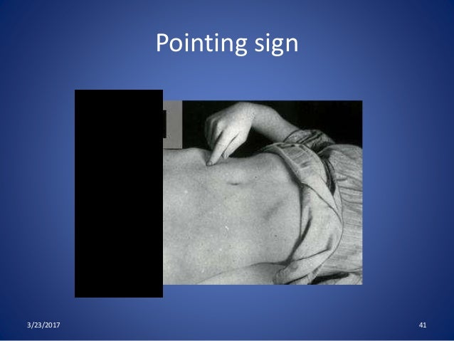 Acute Appendicitis In Adults