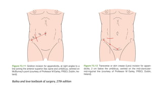 Bailey and love textbook of surgery, 27th edition
 