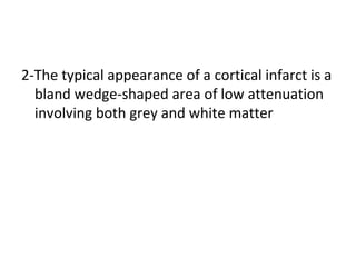 2-The typical appearance of a cortical infarct is a
bland wedge-shaped area of low attenuation
involving both grey and white matter
 