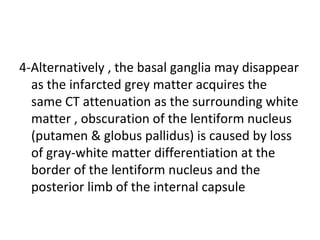 4-Alternatively , the basal ganglia may disappear
as the infarcted grey matter acquires the
same CT attenuation as the surrounding white
matter , obscuration of the lentiform nucleus
(putamen & globus pallidus) is caused by loss
of gray-white matter differentiation at the
border of the lentiform nucleus and the
posterior limb of the internal capsule
 
