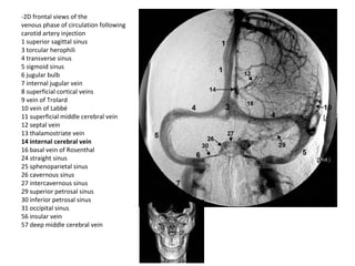 -2D frontal views of the
venous phase of circulation following
carotid artery injection
1 superior sagittal sinus
3 torcular herophili
4 transverse sinus
5 sigmoid sinus
6 jugular bulb
7 internal jugular vein
8 superficial cortical veins
9 vein of Trolard
10 vein of Labbé
11 superficial middle cerebral vein
12 septal vein
13 thalamostriate vein
14 internal cerebral vein
16 basal vein of Rosenthal
24 straight sinus
25 sphenoparietal sinus
26 cavernous sinus
27 intercavernous sinus
29 superior petrosal sinus
30 inferior petrosal sinus
31 occipital sinus
56 insular vein
57 deep middle cerebral vein
 
