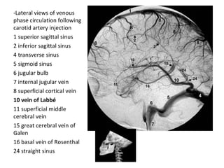 -Lateral views of venous
phase circulation following
carotid artery injection
1 superior sagittal sinus
2 inferior sagittal sinus
4 transverse sinus
5 sigmoid sinus
6 jugular bulb
7 internal jugular vein
8 superficial cortical vein
10 vein of Labbé
11 superficial middle
cerebral vein
15 great cerebral vein of
Galen
16 basal vein of Rosenthal
24 straight sinus
 
