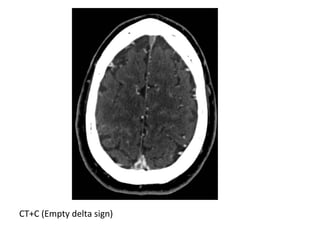 CT+C (Empty delta sign)
 