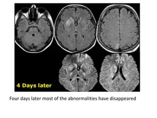 Four days later most of the abnormalities have disappeared
 