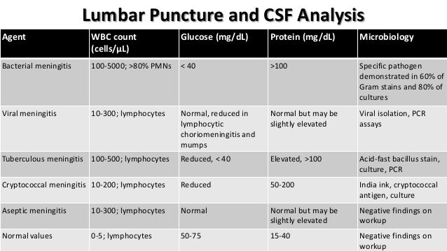 Acute bacterial meningitis Acute bacterial meningitis