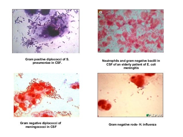gram negative rods in csf gram negative rods in csf