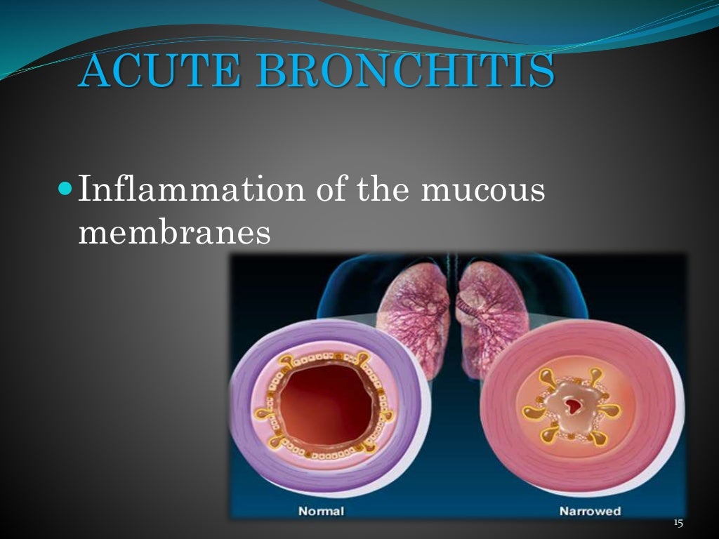 case study for bronchitis