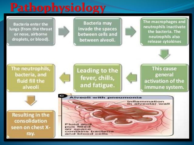 a case presentation on Acute bronchopneumonia
