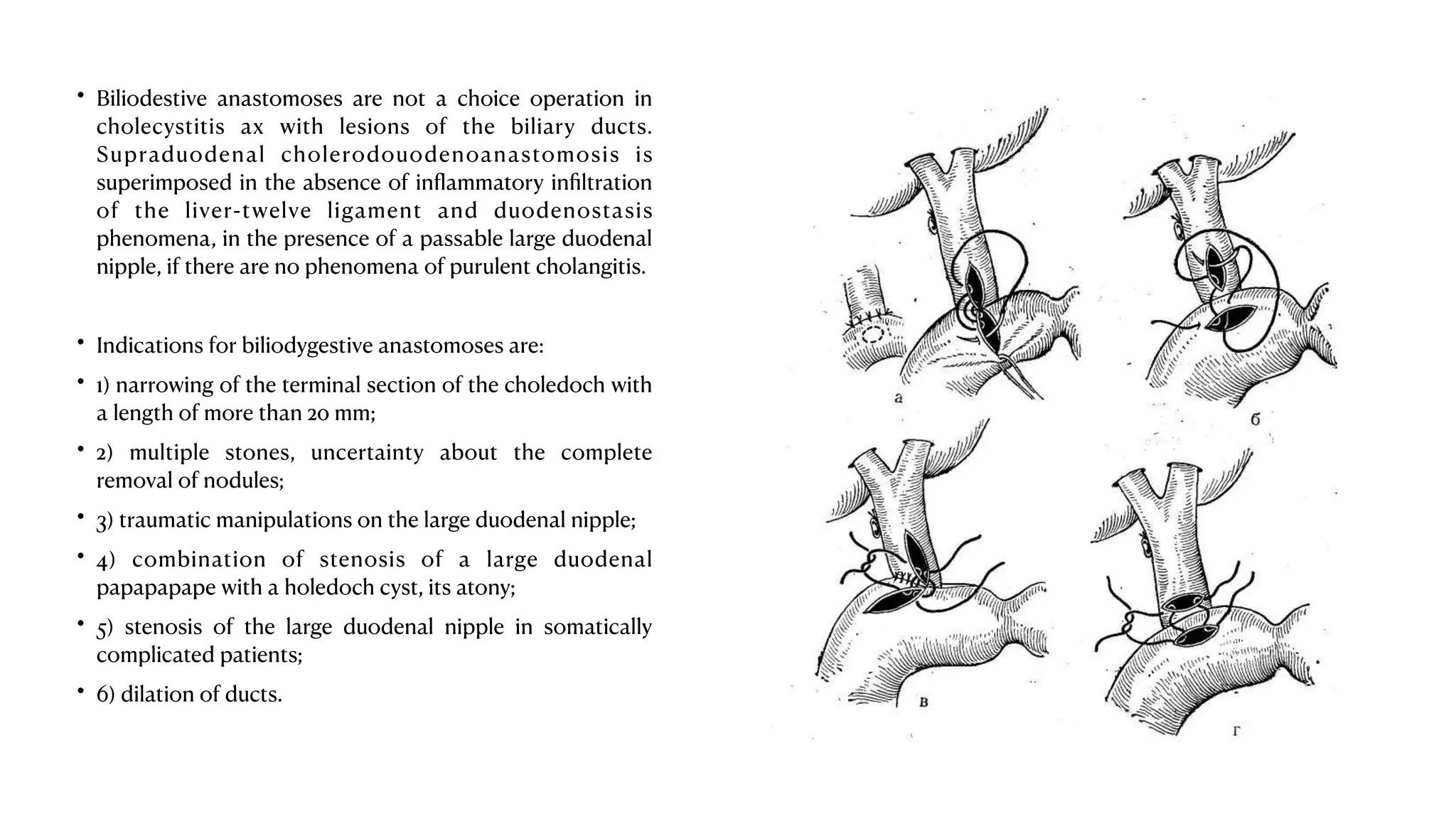 Acute calculosis cholecystitis in general medicine | PDF
