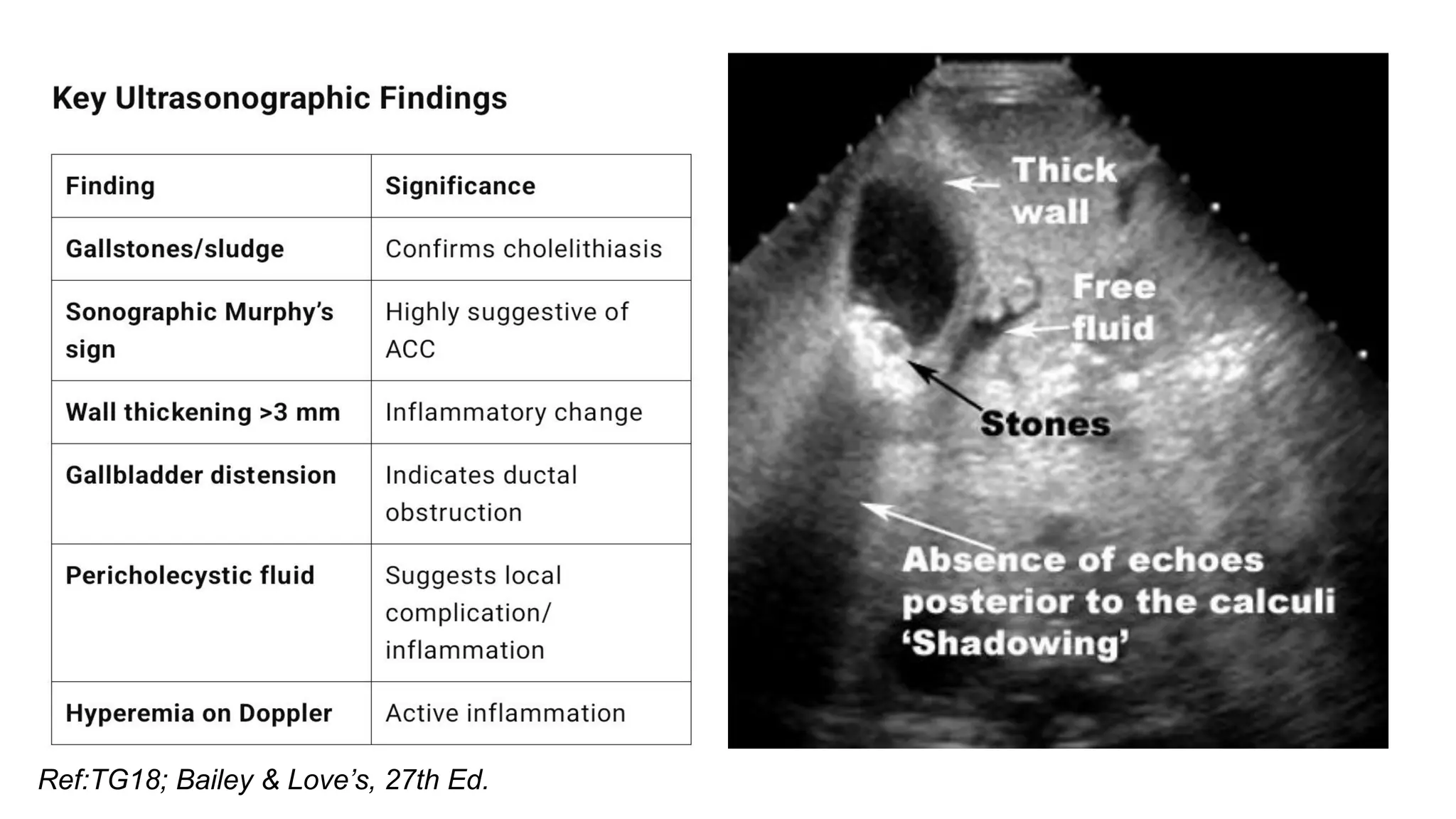 Latest guidelines in management of acalculous acute calculous ...