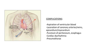 COMPLICATIONS:
-Aspiration of ventricular blood
-Laceration of coronary arteries/veins,
epicardium/myocardium
-Puncture of peritoneum, esophagus
-Cardiac dysrhythmia
-Pneumothorax
 