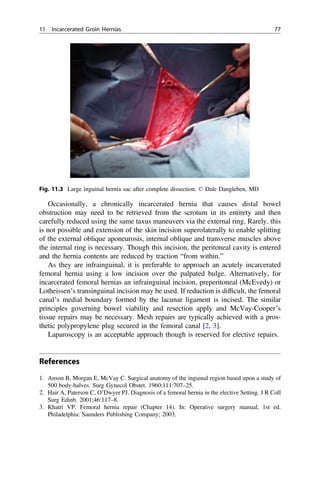 Acute care general surgery | PDF