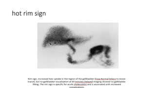 Mn Rim Sign Nuclear Medicine and Radiology in Acute Care: Emergency Management and ...