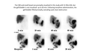 Nuclear Medicine and Radiology in Acute Care: Emergency Management and ...