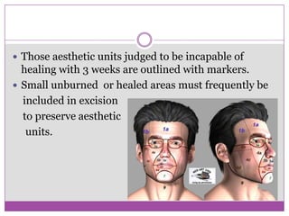 Acute care of  facial burns (7th august 2010)
