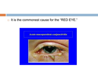 Acute catarrhal or acute muco purulent conjunctivitis | PPTX