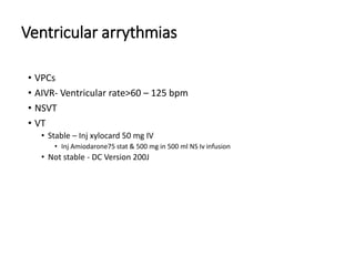 Ventricular arrythmias
• VPCs
• AIVR- Ventricular rate>60 – 125 bpm
• NSVT
• VT
• Stable – Inj xylocard 50 mg IV
• Inj Amiodarone75 stat & 500 mg in 500 ml NS Iv infusion
• Not stable - DC Version 200J
 