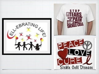 Acute chest syndrome (sickle cell)