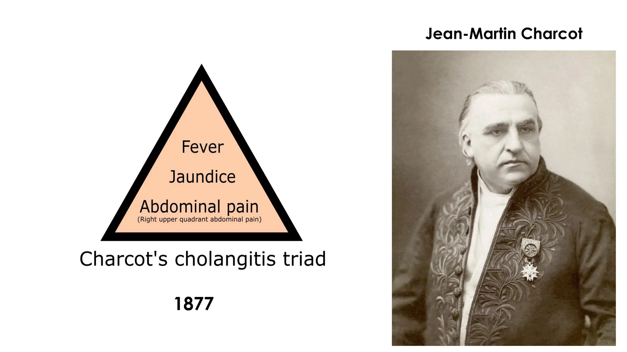 Jean-Martin Charcot
1877
 