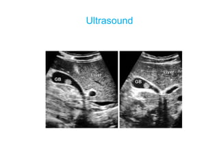 Ultrasound
 