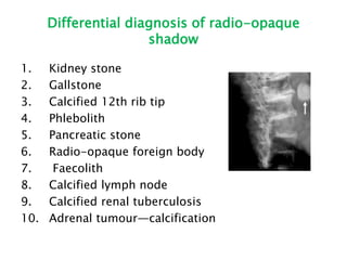 Differential diagnosis of radio-opaque
shadow
1. Kidney stone
2. Gallstone
3. Calcified 12th rib tip
4. Phlebolith
5. Pancreatic stone
6. Radio-opaque foreign body
7. Faecolith
8. Calcified lymph node
9. Calcified renal tuberculosis
10. Adrenal tumour—calcification
 