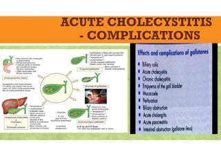 ACUTE CHOLECYSTITIS
- COMPLICATIONS
 