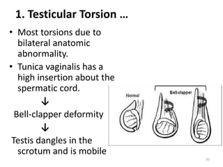 Acute Cholecystitis Cholangitis Tilayae pptx