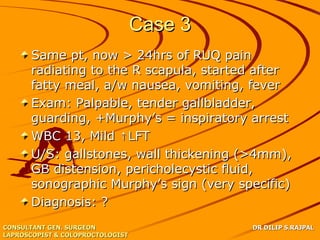 Case 3
      Same pt, now > 24hrs of RUQ pain
      radiating to the R scapula, started after
      fatty meal, a/w nausea, vomiting, fever
      Exam: Palpable, tender gallbladder,
      guarding, +Murphy’s = inspiratory arrest
      WBC 13, Mild ↑LFT
      U/S: gallstones, wall thickening (>4mm),
      GB distension, pericholecystic fluid,
      sonographic Murphy’s sign (very specific)
      Diagnosis: ?
CONSULTANT GEN. SURGEON                    DR DILIP S.RAJPAL
LAPROSCOPIST & COLOPROCTOLOGIST
 