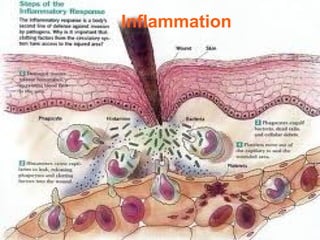 Comprehensive Overview of Inflammation: Mechanisms, Types, and Outcomes ...