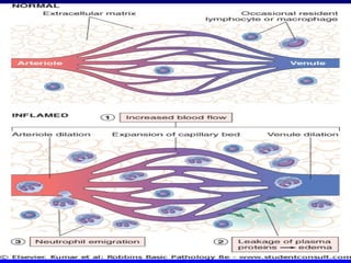 Comprehensive Overview of Inflammation: Mechanisms, Types, and Outcomes ...