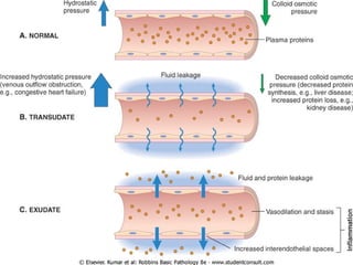 Comprehensive Overview of Inflammation: Mechanisms, Types, and Outcomes ...