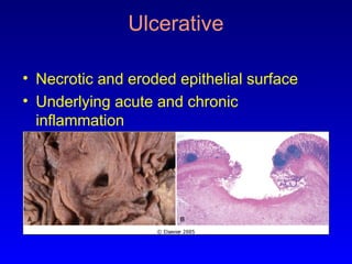 Comprehensive Overview of Inflammation: Mechanisms, Types, and Outcomes ...
