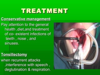 TREATMENTTREATMENT
Conservative managementConservative management
Pay attention to the generalPay attention to the general
health ,diet,and treatmenthealth ,diet,and treatment
of co- existent infections ofof co- existent infections of
teeth , nose , andteeth , nose , and
sinuses.sinuses.
TonsillectomyTonsillectomy
when recurrent attackswhen recurrent attacks
,interference with speech ,,interference with speech ,
deglutination & respiration.deglutination & respiration.
 