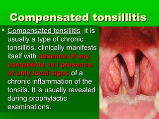 Compensated tonsillitisCompensated tonsillitis
 Compensated tonsillitisCompensated tonsillitis it isit is
usually a type of chronicusually a type of chronic
tonsillitis. clinically manifeststonsillitis. clinically manifests
itself withitself with absence of anyabsence of any
complaintscomplaints andand presencepresence
of only local signsof only local signs of aof a
chronic inflammation of thechronic inflammation of the
tonsils. It is usually revealedtonsils. It is usually revealed
during prophylacticduring prophylactic
examinations.examinations.
 