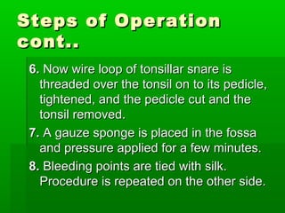 Steps of OperationSteps of Operation
cont..cont..
6.6. Now wire loop of tonsillar snare isNow wire loop of tonsillar snare is
threaded over the tonsil on to its pedicle,threaded over the tonsil on to its pedicle,
tightened, and the pedicle cut and thetightened, and the pedicle cut and the
tonsil removed.tonsil removed.
7.7. A gauze sponge is placed in the fossaA gauze sponge is placed in the fossa
and pressure applied for a few minutes.and pressure applied for a few minutes.
8.8. Bleeding points are tied with silk.Bleeding points are tied with silk.
Procedure is repeated on the other side.Procedure is repeated on the other side.
 
