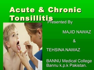 Acute & ChronicAcute & Chronic
TonsillitisTonsillitisPresented ByPresented By
MAJID NAWAZMAJID NAWAZ
&&
TEHSINA NAWAZTEHSINA NAWAZ
BANNU Medical CollegeBANNU Medical College
Bannu k.p.k Pakistan.Bannu k.p.k Pakistan.
 