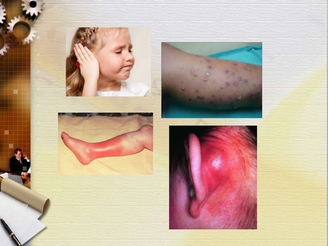 Acute cns infection in children | PPTX | Infectious Diseases | Diseases ...
