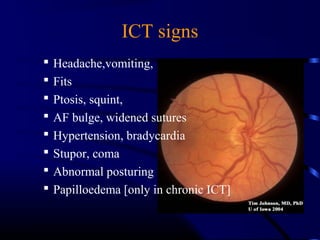 ICT signs
 Headache,vomiting,
 Fits
 Ptosis, squint,
 AF bulge, widened sutures
 Hypertension, bradycardia
 Stupor, coma
 Abnormal posturing
 Papilloedema [only in chronic ICT]
 